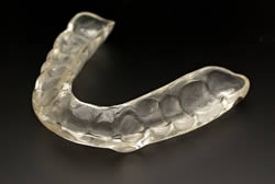 Penrith Dental Clinic | Teeth Grinding Dental Appliance - Dentist Sydney