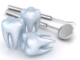 dental implants not scary